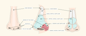 Revision Rhinoplasty