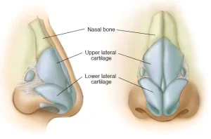 Rhinoplastie en Turquie