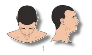 1-Minimal or No Hair Loss - Norwood Hair Scale