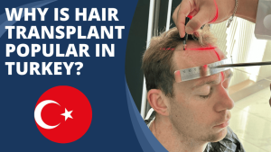 Turkey hair transplant