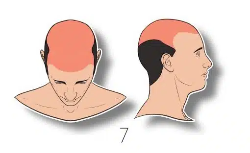 רוב השיער נשר