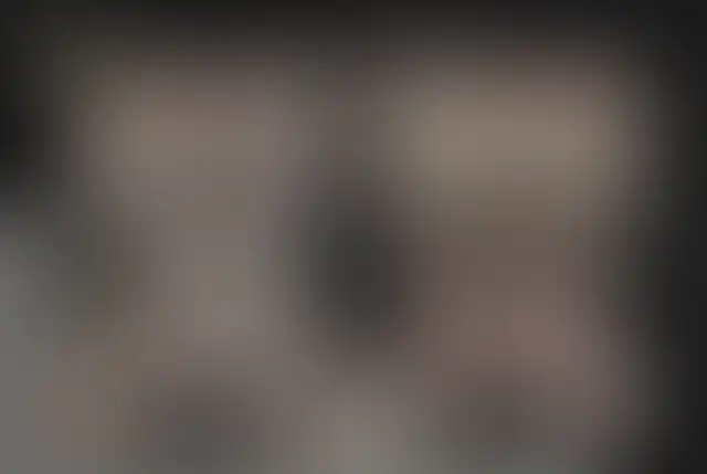 Photographie masquée d’un patient ClinMedica avant et après l’intervention