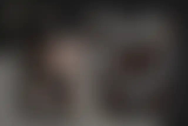 Fotografía cubierta de un paciente de ClinMedica antes y después de la cirugía