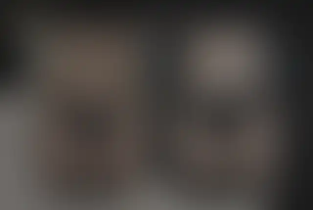 Fotografía cubierta de un paciente de ClinMedica antes y después de la cirugía