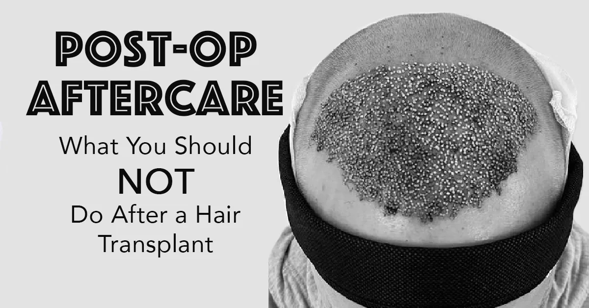 Cura post-operatoria Cosa deve fare dopo un trapianto di capelli