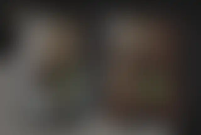 Photographie masquée d’un patient ClinMedica avant et après l’intervention