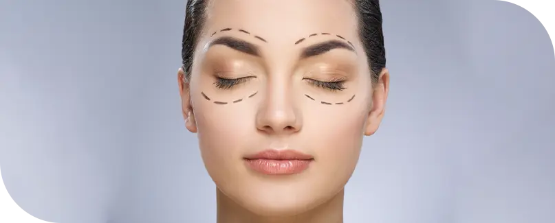 Blepharoplasty Surgery In Turkey