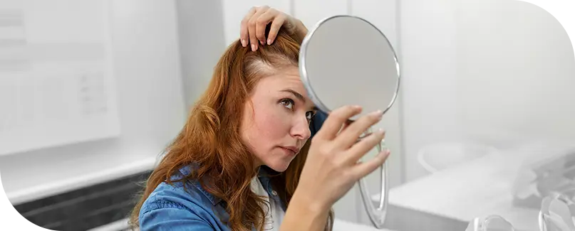 AGF Hair loss treatments