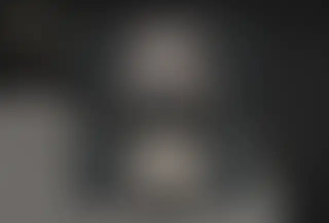 Fotografía cubierta de un paciente de ClinMedica antes y después de la cirugía