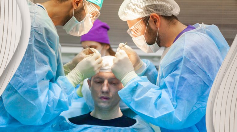 best hair transplant in turkey