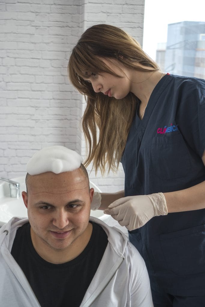 Metodo di lavaggio della testa dopo l'operazione di trapianto di capelli