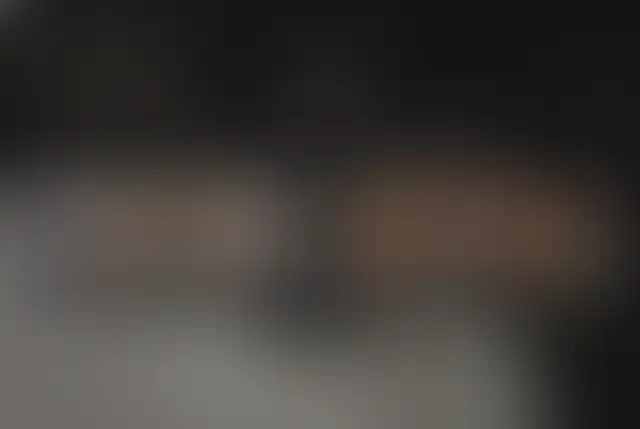 Photographie masquée d’un patient ClinMedica avant et après l’intervention