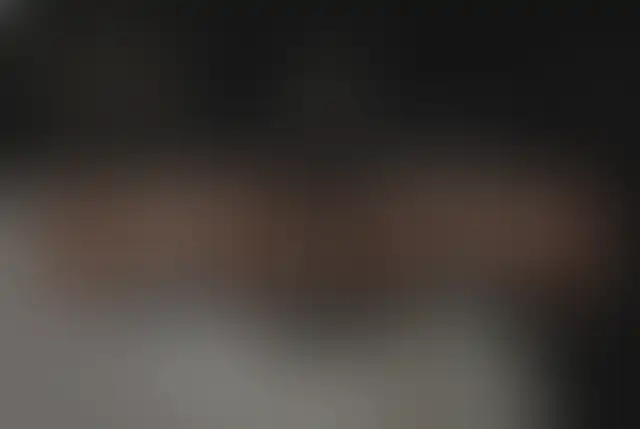 Photographie masquée d’un patient ClinMedica avant et après l’intervention