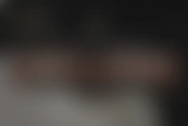Photographie masquée d’un patient ClinMedica avant et après l’intervention