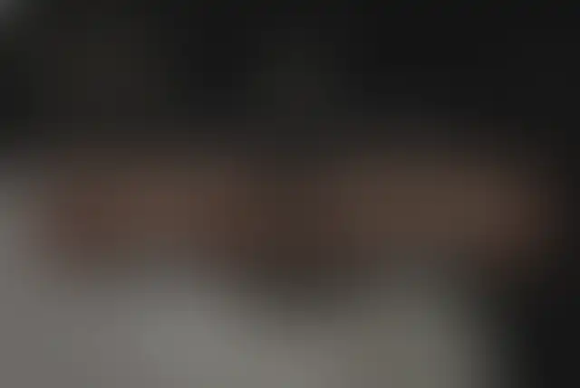 Photographie masquée d’un patient ClinMedica avant et après l’intervention