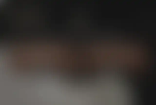 Photographie masquée d’un patient ClinMedica avant et après l’intervention