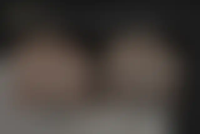 Photographie masquée d’un patient ClinMedica avant et après l’intervention