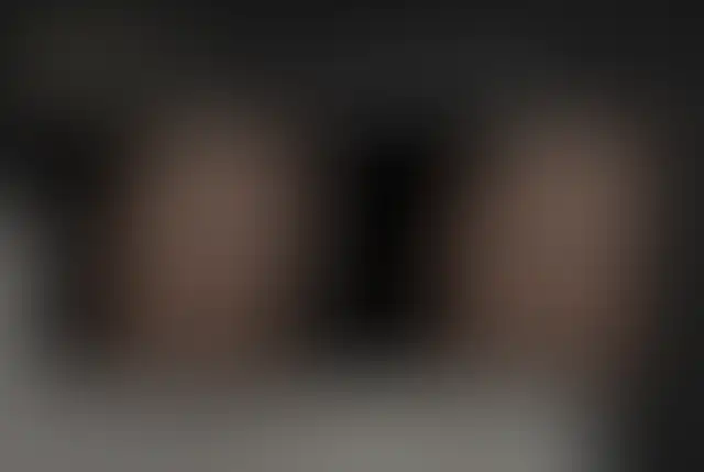 Photographie masquée d’un patient ClinMedica avant et après l’intervention