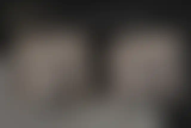 Photographie masquée d’un patient ClinMedica avant et après l’intervention