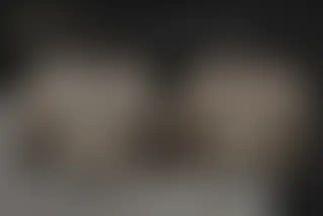 Photographie masquée d’un patient ClinMedica avant et après l’intervention