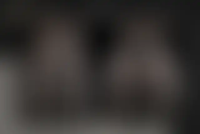 Covered photograph of a ClinMedica patient before and after surgery