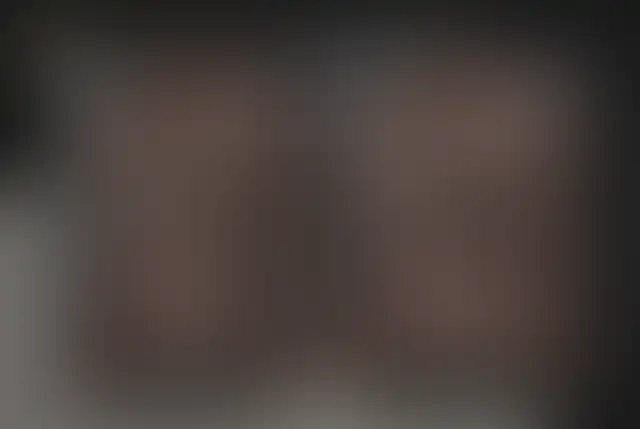 Fotografia coperta di un paziente ClinMedica prima e dopo l’intervento