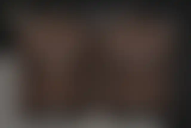 Fotografia coperta di un paziente ClinMedica prima e dopo l’intervento