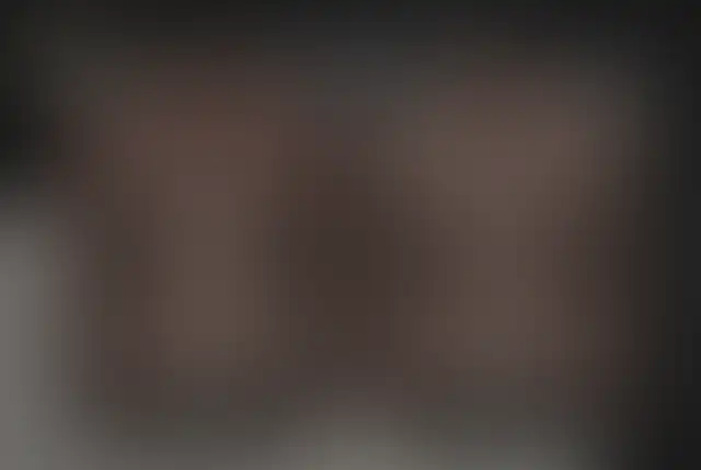 Fotografia coperta di un paziente ClinMedica prima e dopo l’intervento