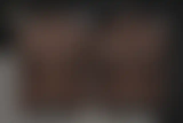 Fotografia coperta di un paziente ClinMedica prima e dopo l’intervento