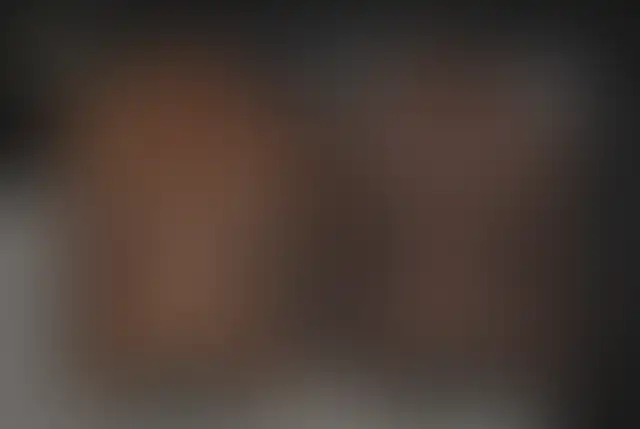 Fotografia coperta di un paziente ClinMedica prima e dopo l’intervento