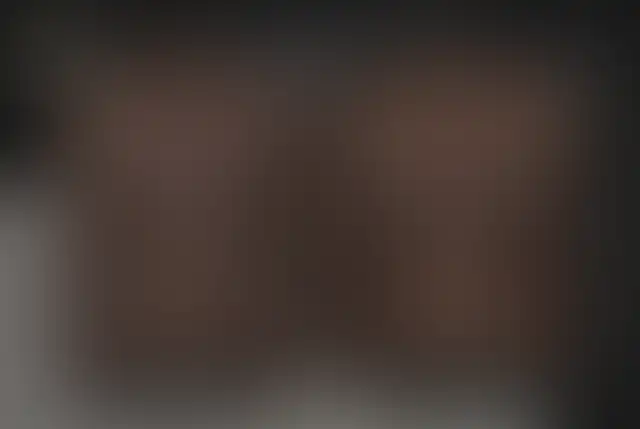 Fotografia coperta di un paziente ClinMedica prima e dopo l’intervento