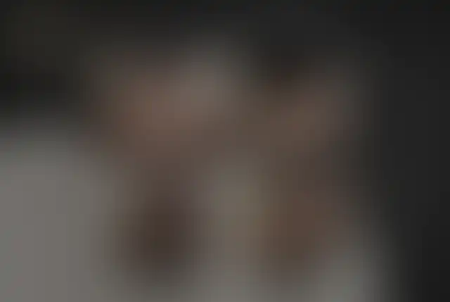 Fotografia coperta di un paziente ClinMedica prima e dopo l’intervento