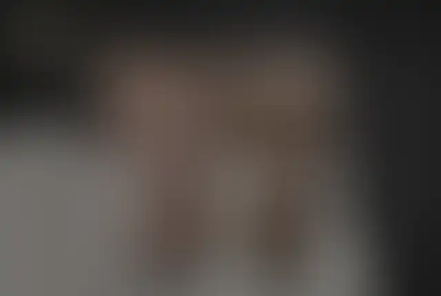 Fotografia coperta di un paziente ClinMedica prima e dopo l’intervento