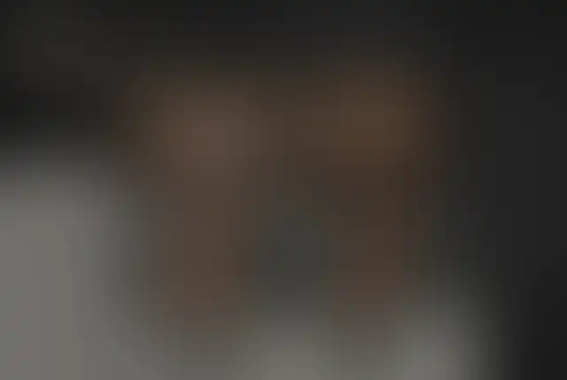 Fotografia coperta di un paziente ClinMedica prima e dopo l’intervento