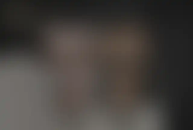 Fotografia coperta di un paziente ClinMedica prima e dopo l’intervento