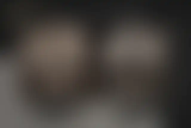 Fotografia coperta di un paziente ClinMedica prima e dopo l’intervento
