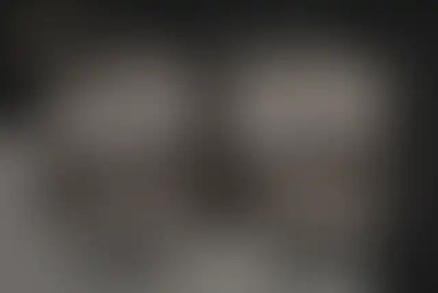 Fotografia coperta di un paziente ClinMedica prima e dopo l’intervento