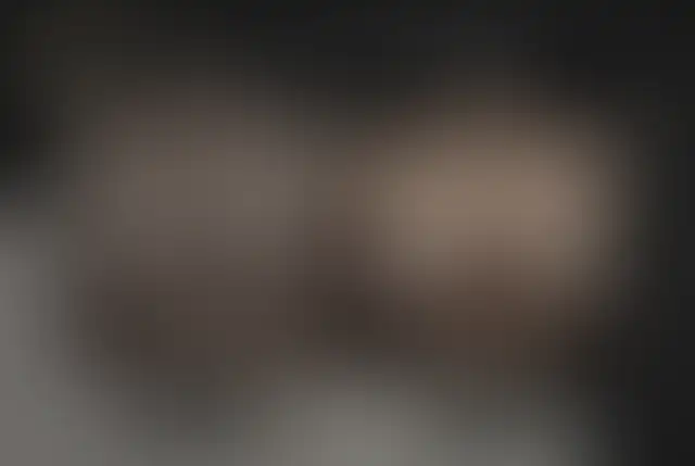 Fotografia coperta di un paziente ClinMedica prima e dopo l’intervento
