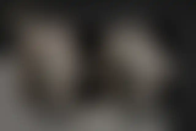 Fotografia coperta di un paziente ClinMedica prima e dopo l’intervento