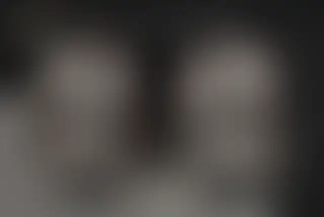 Fotografia coperta di un paziente ClinMedica prima e dopo l’intervento