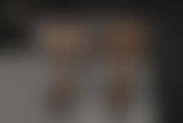 Fotografia coperta di un paziente ClinMedica prima e dopo l’intervento