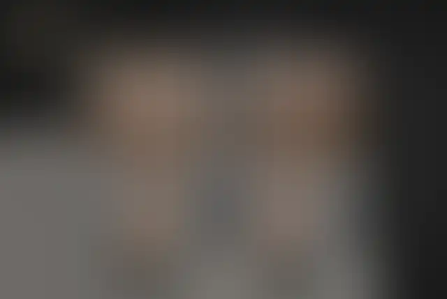 Fotografia coperta di un paziente ClinMedica prima e dopo l’intervento
