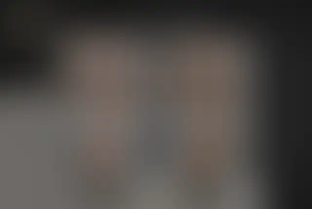 Fotografia coperta di un paziente ClinMedica prima e dopo l’intervento