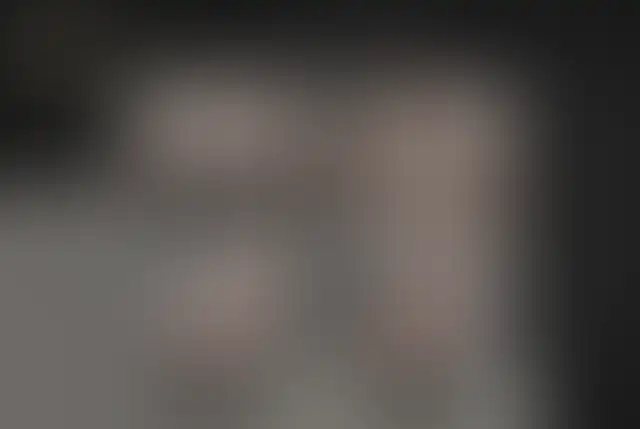 Fotografia coperta di un paziente ClinMedica prima e dopo l’intervento