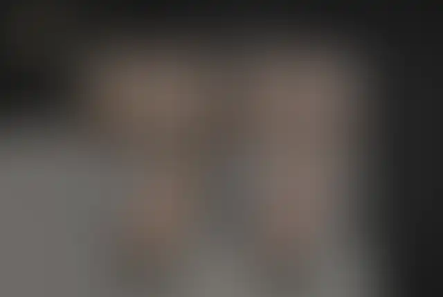Fotografia coperta di un paziente ClinMedica prima e dopo l’intervento