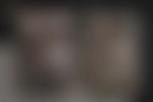 Verdecktes Foto eines ClinMedica-Patienten vor und nach der Operation