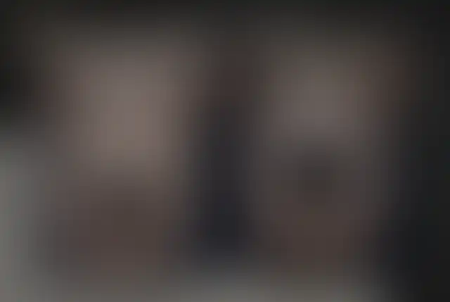 Photographie masquée d’un patient ClinMedica avant et après l’intervention