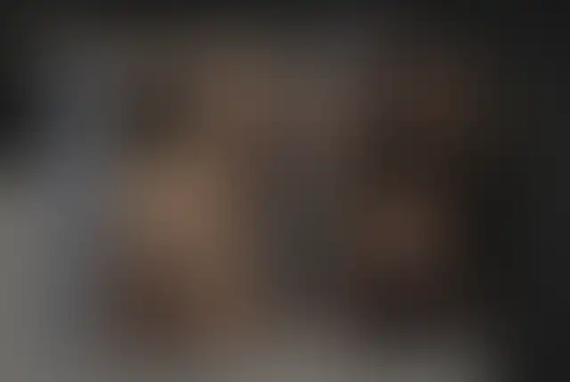 Photographie masquée d’un patient ClinMedica avant et après l’intervention