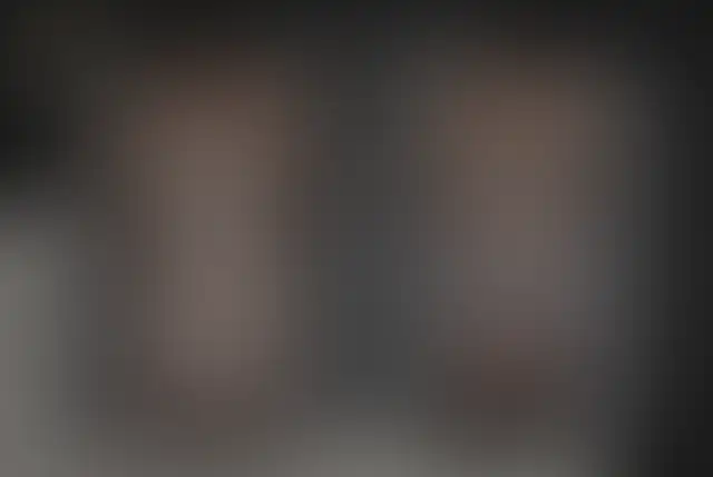 Photographie masquée d’un patient ClinMedica avant et après l’intervention