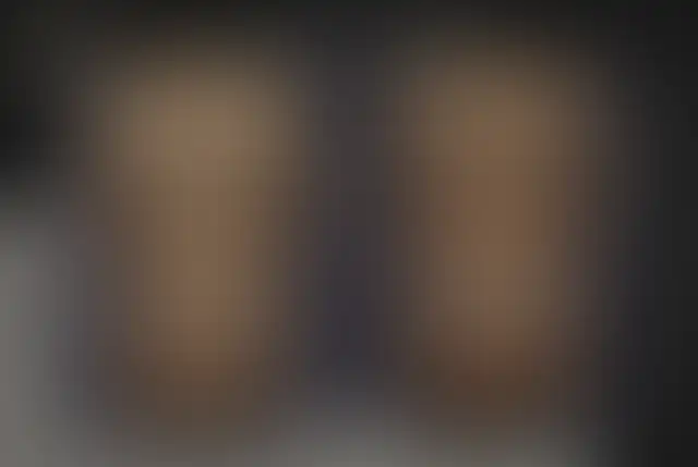 Photographie masquée d’un patient ClinMedica avant et après l’intervention